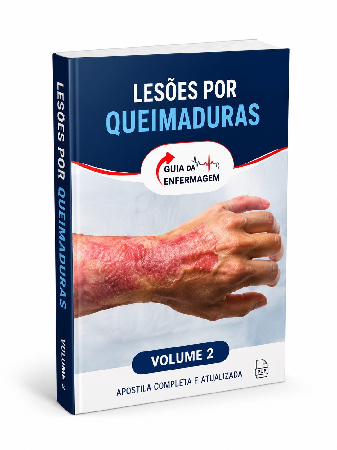 Apostila Lesões por Queimaduras - Volume 2 - Guia Enfermagem
